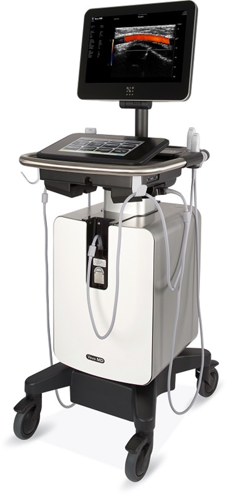 富士フイルムの超音波画像診断装置、0.5mm以下の血管も明瞭に観察